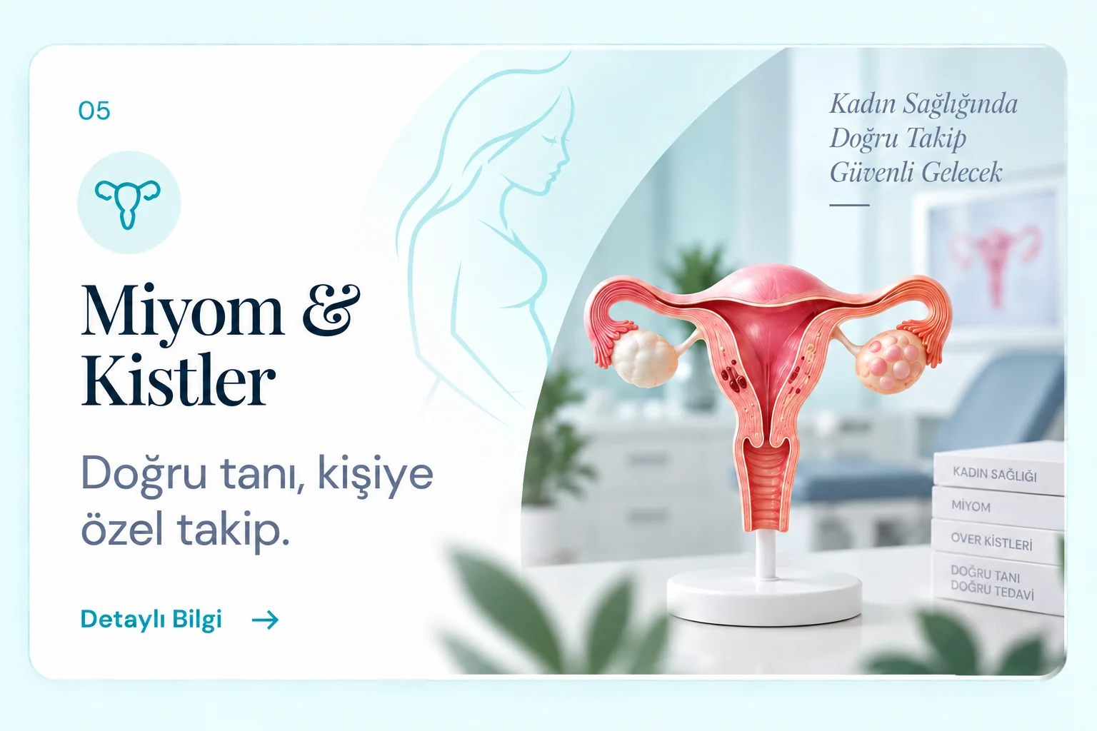 Miyom ve Kistler